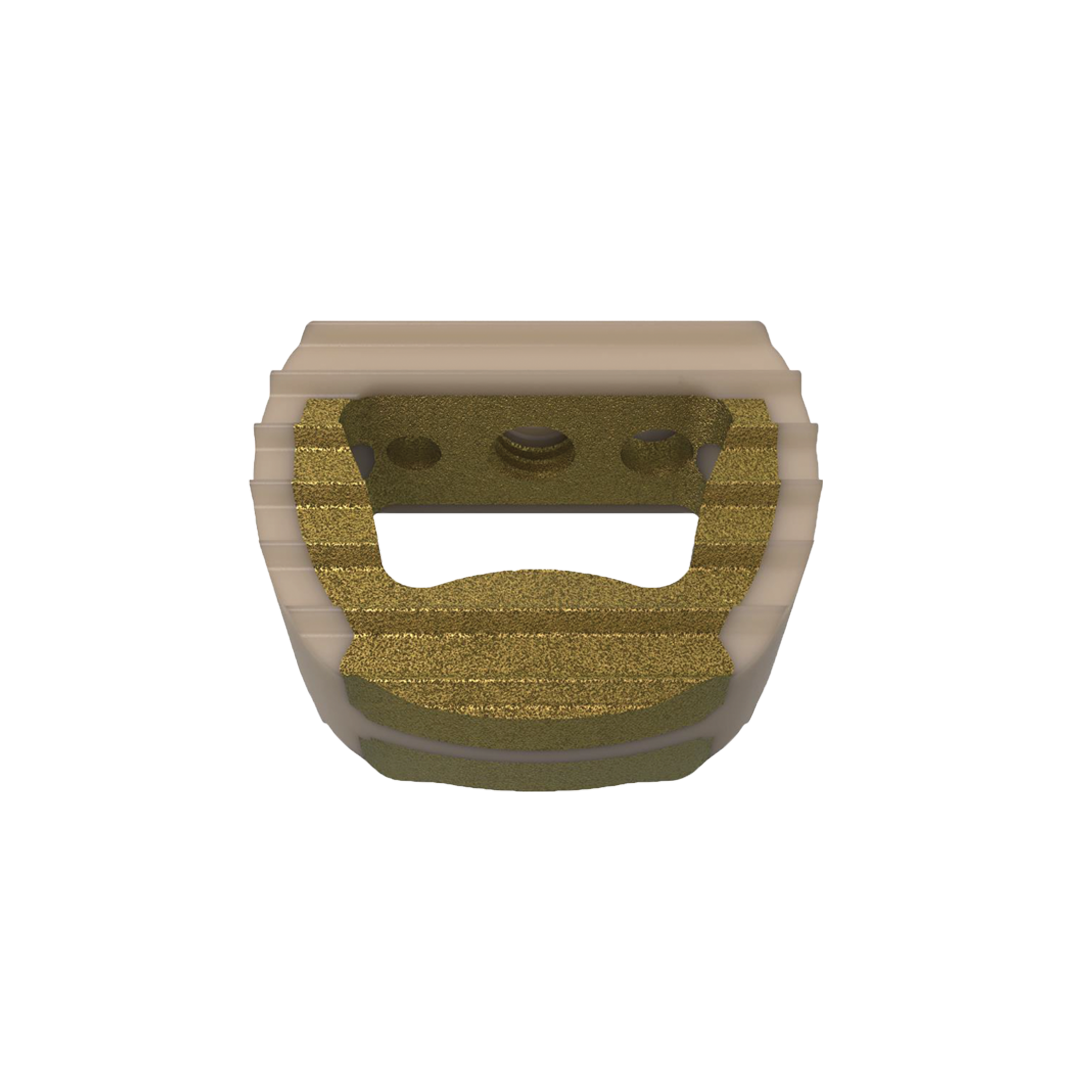 VENUS Cervical Intervertebral Cage